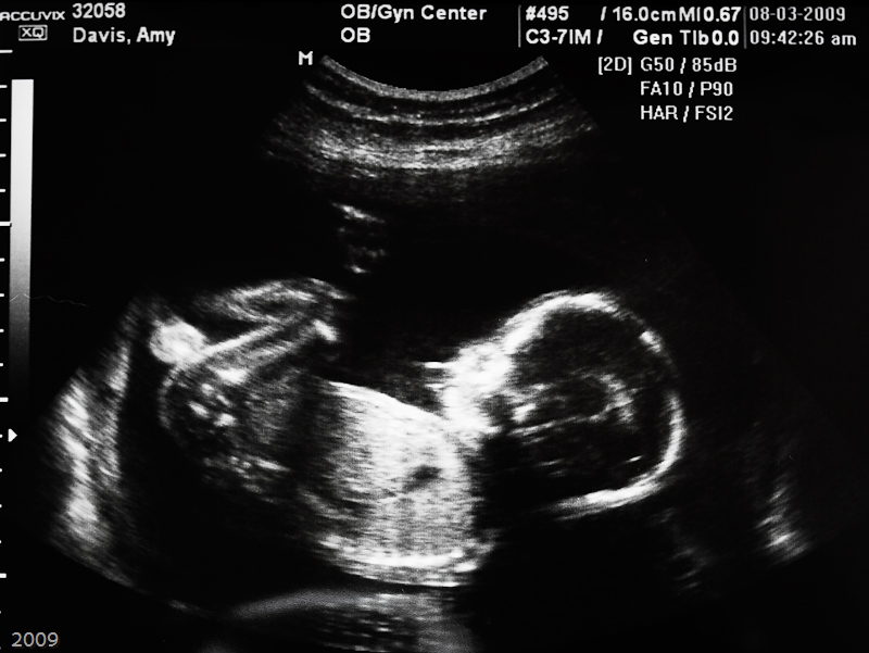 Baby at 20 weeks