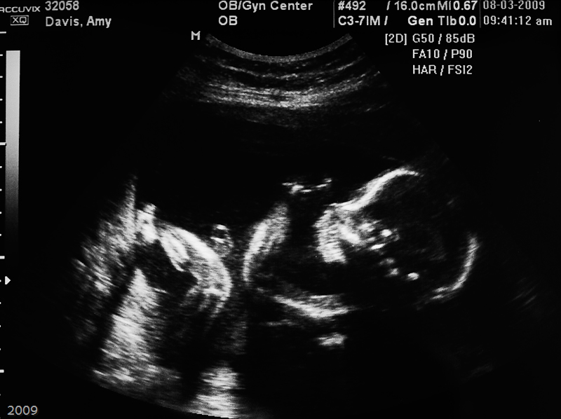 Baby at 20 weeks