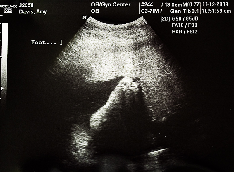 35 Week Ultrasound Feet