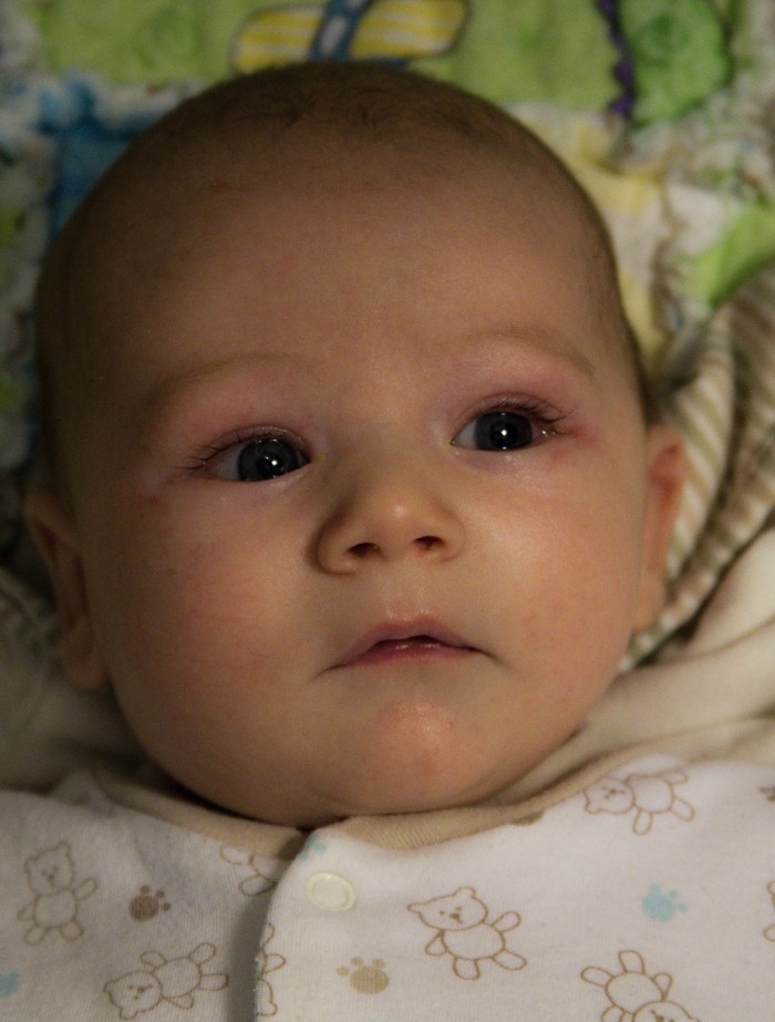 Eli at 8 Weeks